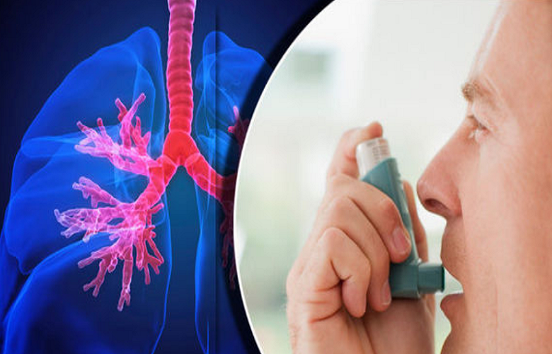 What Kinds of Health Issues Does Asthma Specialist Treat?